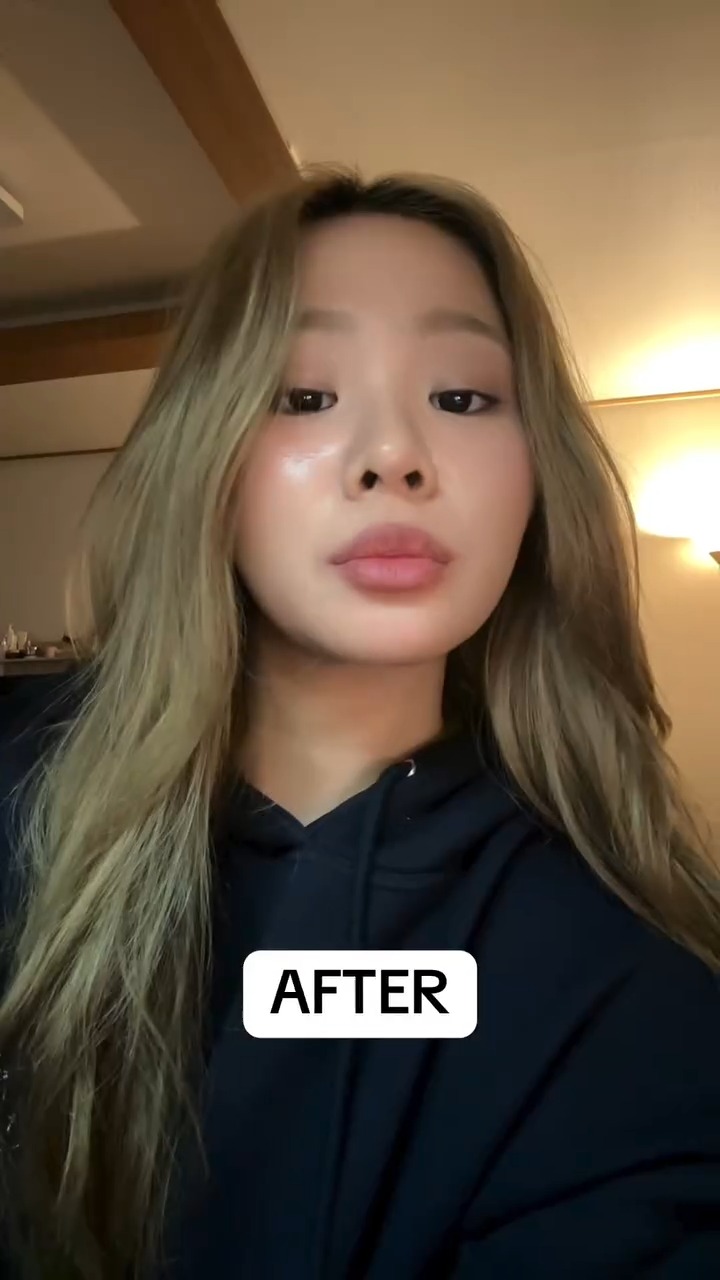 Nohd Dermatology [Clinic], Gangnam-gu