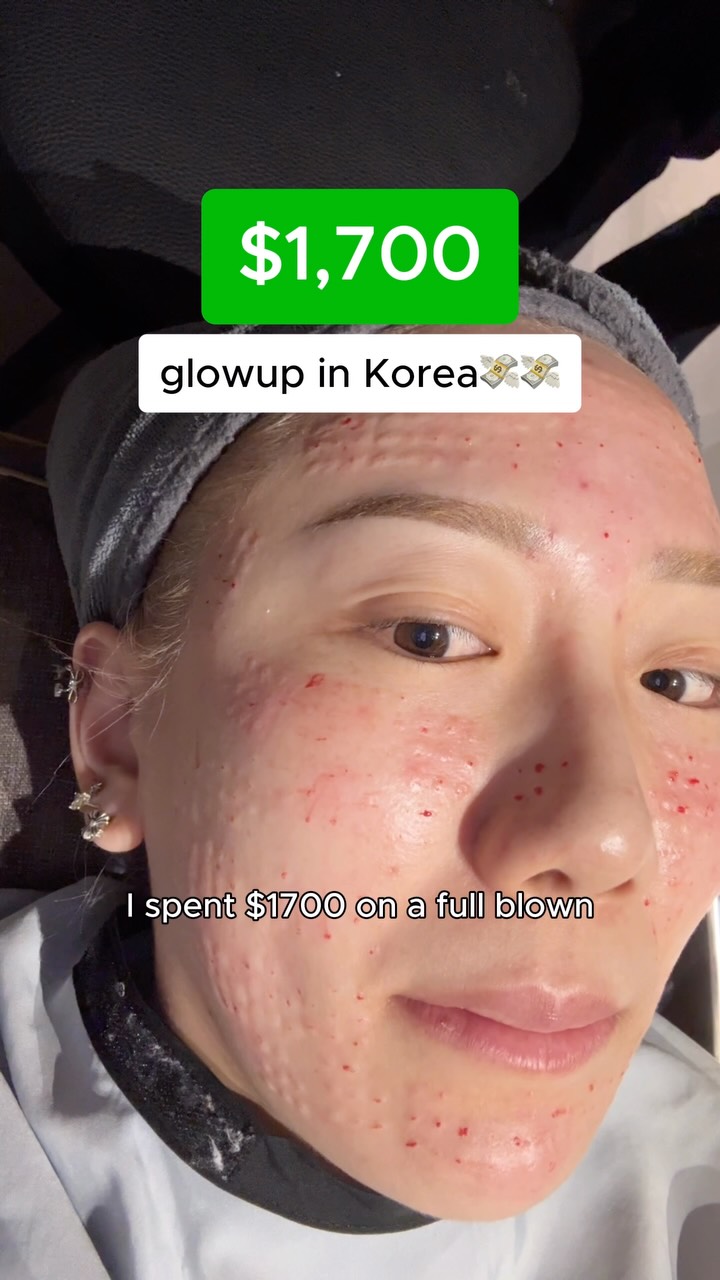 angella🦋, Vands Clinic Myeongdong